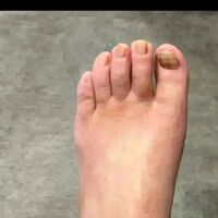 画像1592