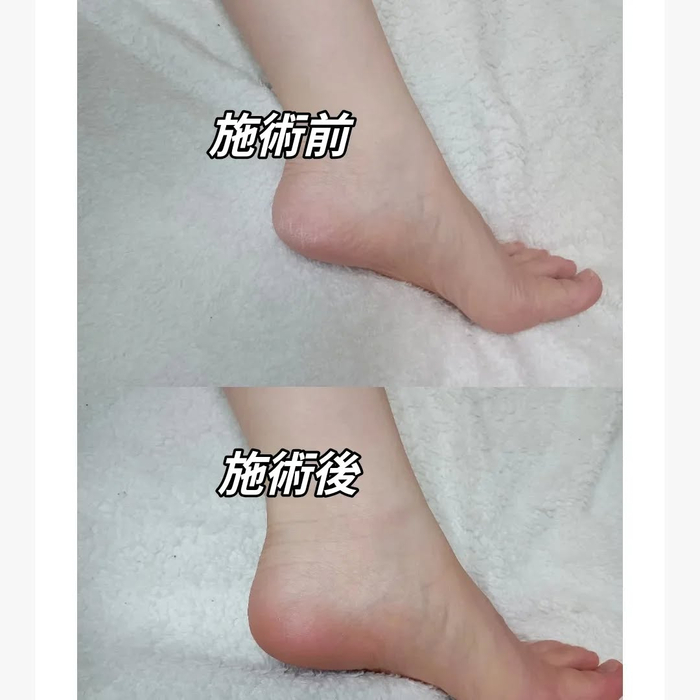 画像6176