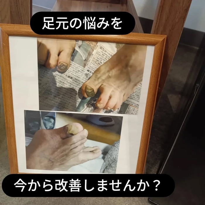 画像6911