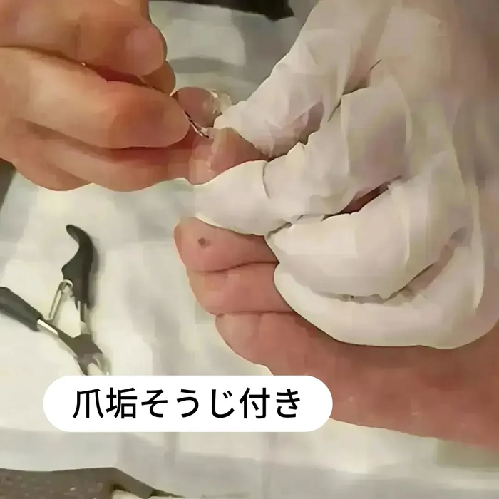 画像7177