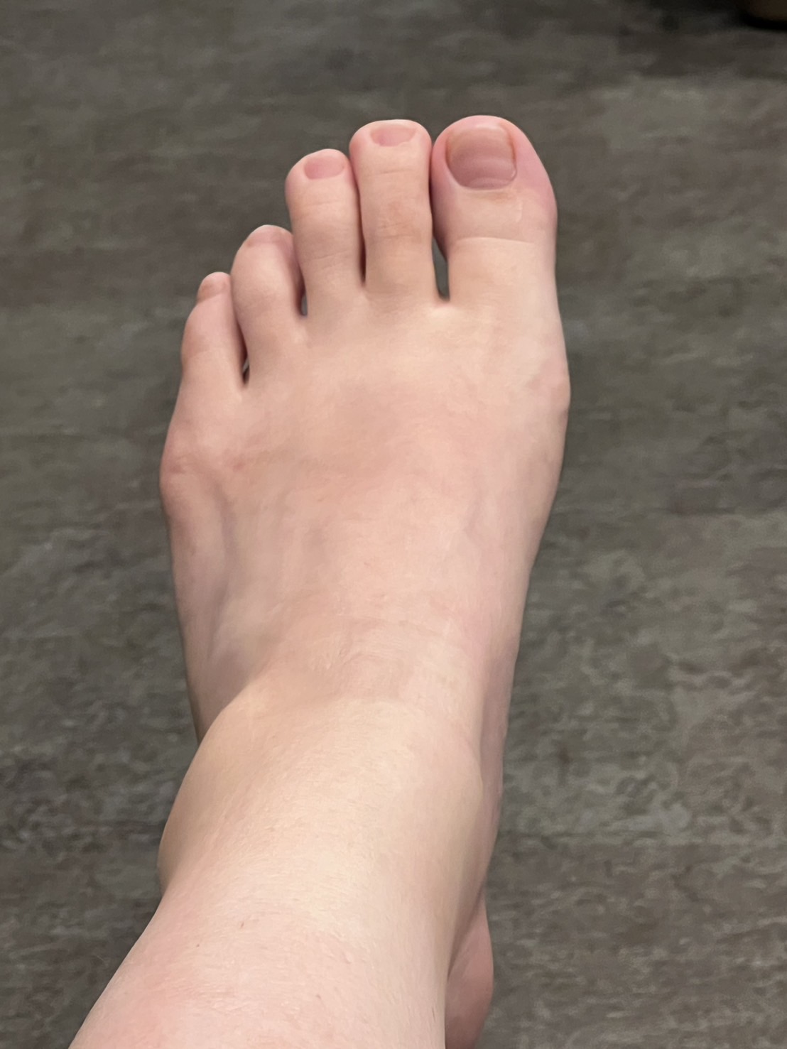 足